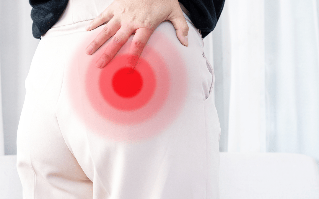 Piriformis Syndrome: What Is It & How Can Sports Massage Help?
